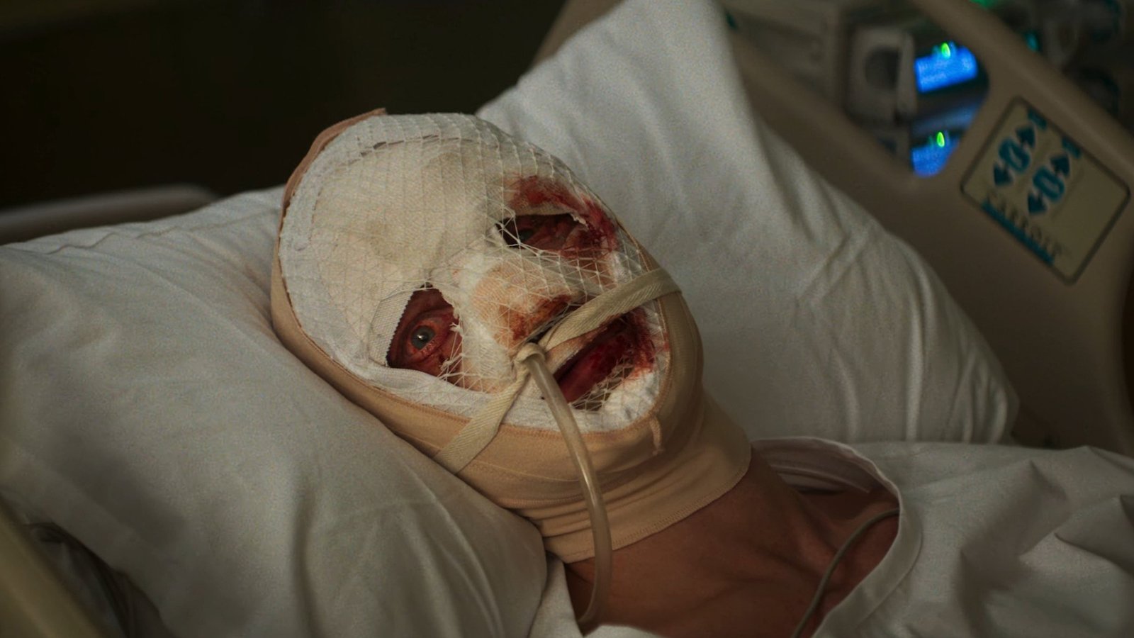 Matt Hagen at the hospital in Clayface